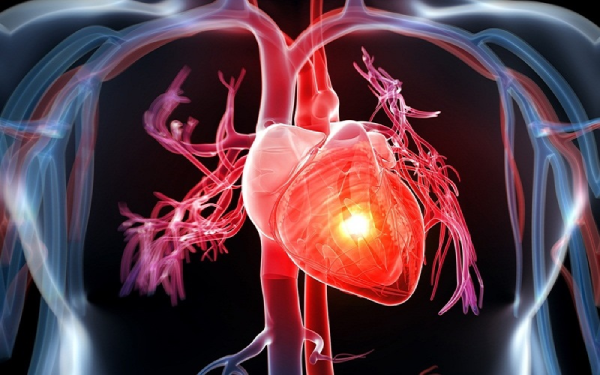 Suy tim là một trong những biến chứng của bệnh